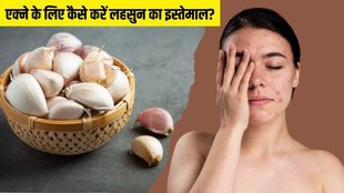 Garlic for acne । Garlic for skin । Garlic for pimple