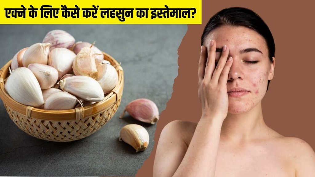 Garlic for acne । Garlic for skin । Garlic for pimple