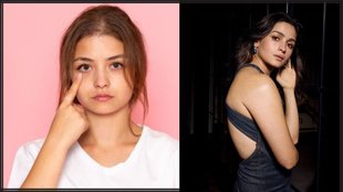 Alia Bhatt । Alia Bhatt skin Care । Puffy Eyes