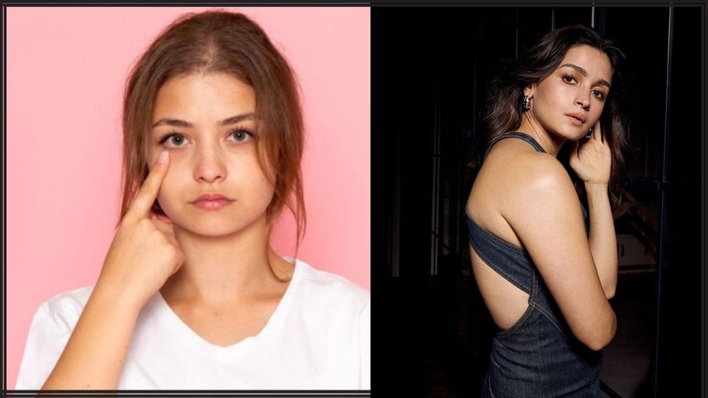 Alia Bhatt । Alia Bhatt skin Care । Puffy Eyes