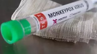 mpox, Mpox In India, Mpox first case in delhi,
