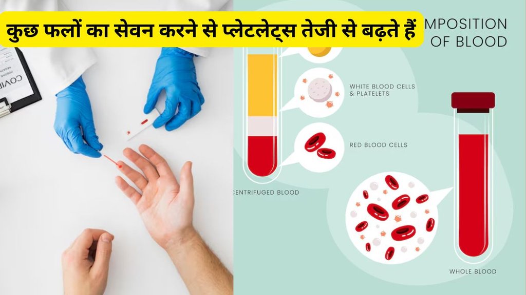 dengure, natural ways to increase Platelet, diet for increase Platelet, natural remedies to quickly increase platelet,What causes a low platelet count, How to Naturally Increase Your Platelet Count,