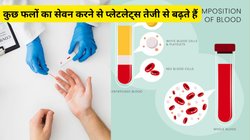 डेंगू की खतरनाक आहट से हो जाएं सावधान, पहले से Platelet Count बढ़ा लें, इन 5 फलों को डाइट में आज से कर लें शामिल