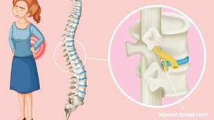 spinal Cord Injury, Spinal cord, spinal cord fracture, osteoporosis, spinal cord injury symptoms, paraplegia spinal cord injury, Spinal cord function and structure,