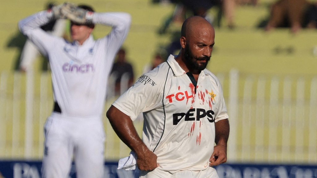 pakistan, sajid khan, PAK vs England 2nd Test Match, Sajid Khan Bleeding, Sajid Khan Injured