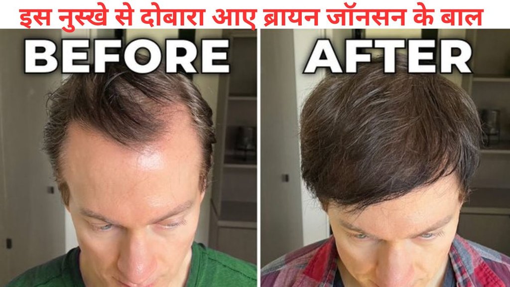 Bryan Johnson Hair Loss, hair fall, hair growth, hair care