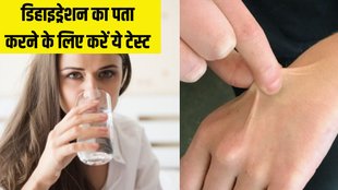 dehydration । dehydration Test । Health News