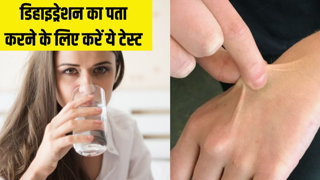 dehydration । dehydration Test । Health News