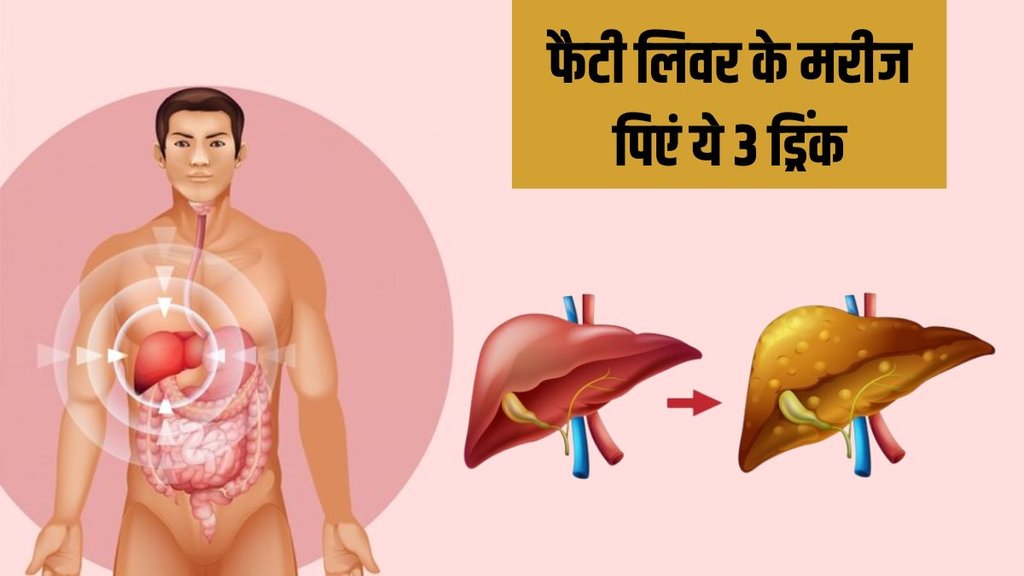 Fatty Liver । Best Drink For Fatty Liver । Fatty Liver Treatment