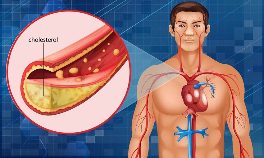 Garlic in Diabetes