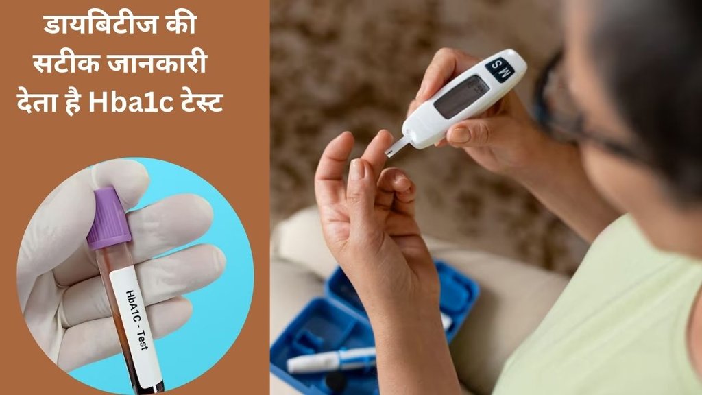 diabetes, blood sugar, diabetes cure, Why would a doctor order a HbA1c, Why is HbA1c used as a test for diabetes,Hemoglobin A1C (HbA1c) Test, HbA1c test,HbA1c test normal range,