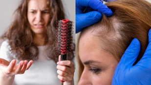 Hair fall foods