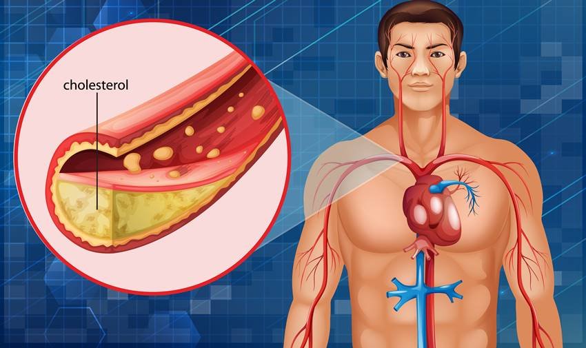 foods can increase cholesterol