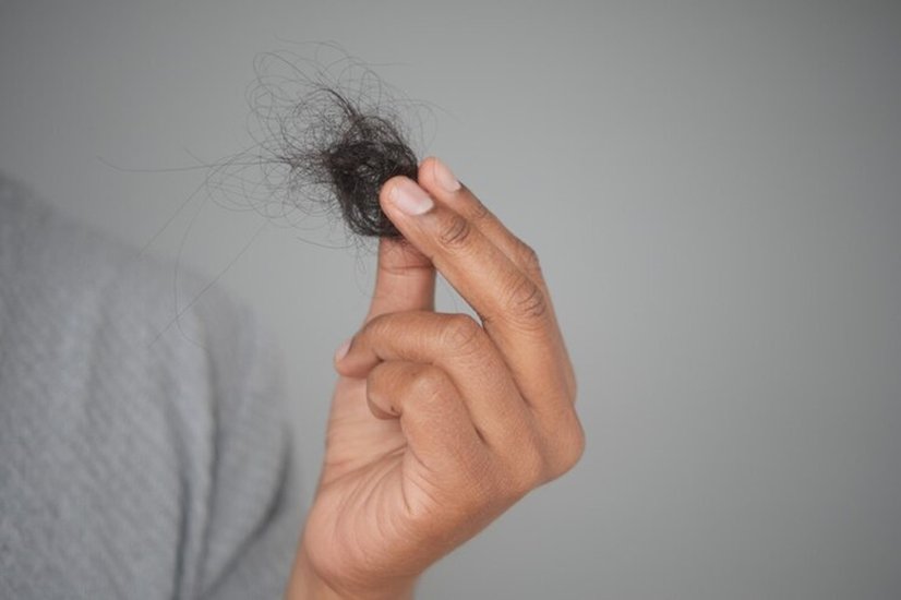 Impact of diet on hair health