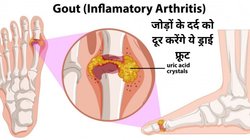 बढ़े हुए Uric Acid को कम करने के लिए तुरंत छोड़ दें ये 8 चीजें, डाइट में शामिल करें ये 4 ड्राई फ्रूट, जोड़ों का दर्द होगा दूर और टल जाएगा गाउट का खतरा