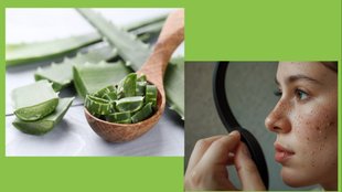 Aloe Vera for Dark Spots