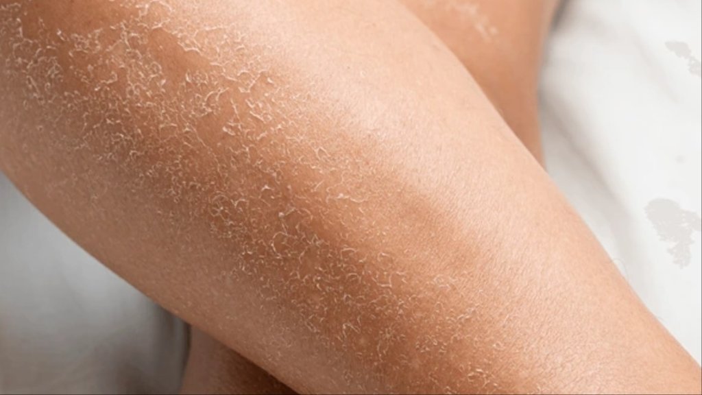 how to use glycerin for dry skin