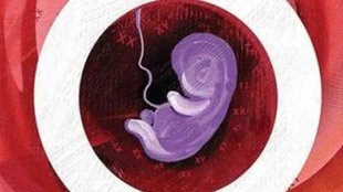 Sex Determination Act | IMA