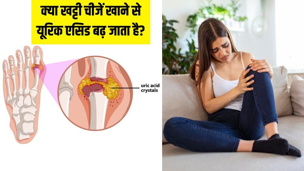 Which foods increase uric acid । Uric Acid । uric acid treatment