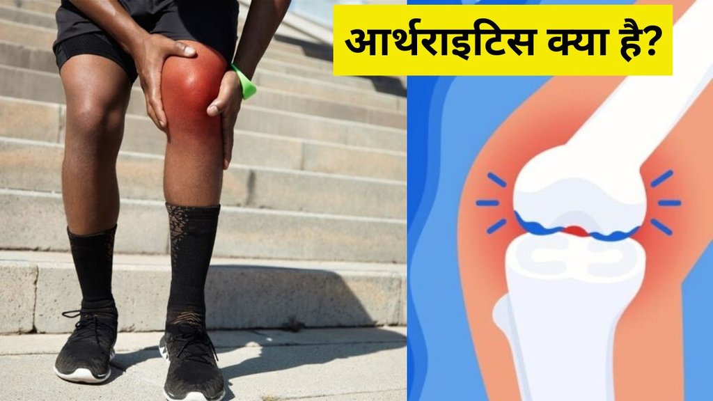 World Arthritis Day 2024 । World Arthritis Day । World Arthritis Day Date