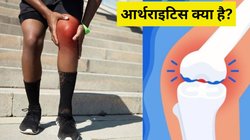 World Arthritis Day 2024: आर्थराइटिस क्या है? एक्सपर्ट्स से जानें किन लोगों को होता है इसका खतरा, कैसे करें बचाव