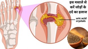 amazing health benefits of ajwain for uric acid control uric acid control, uric acid control tips, uric acid control spice,uric acid control diet,uric acid symptoms,causes of uric acid