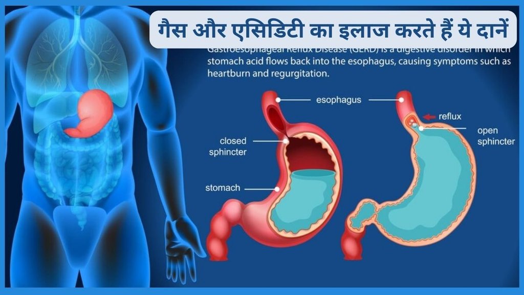 health benefits of fennel seeds, health benefits of fennel seeds tea, health benefits of fennel seeds daily, health benefits of fennel seeds and, health benefits of fennel tea
