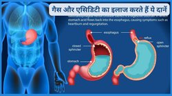 खाने के बाद 1 चम्मच इस सीड्स को चबा लें, गैस और असिडिटी का बिना दवा हो जाएगा इलाज, एक्सपर्ट से जानिए कैसे