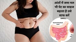 आंतों में जमा गंदगी भी बढ़ाती है आपके पेट का साइज, इन 4 आयुर्वेदिक तरीकों को अपनाएं कोलन की हो जाएगी सफाई, Belly Fat रहेगा कंट्रोल