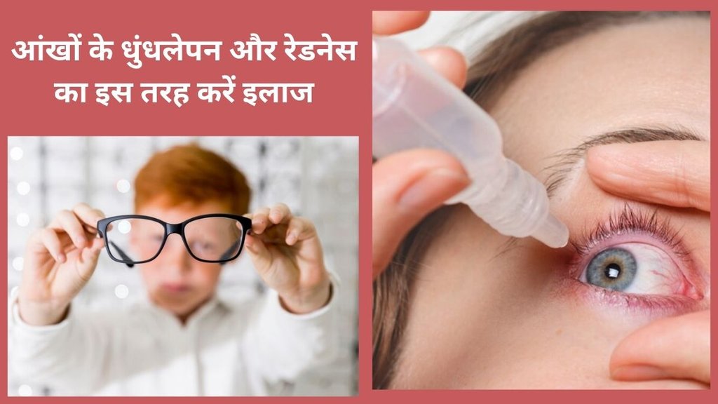 eyes care,Eye Allergy,Eye Allergy symptoms,Seasonal Allergy sign, Seasonal Allergy symptoms,how to treat Seasonal eye Allergy,