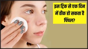 How to get rid of a pimple fast । Quick Fix for pimple । How to remove a pimple overnight