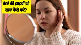 Can skin pigmentation be cured । Skin Care । Beauty Tips