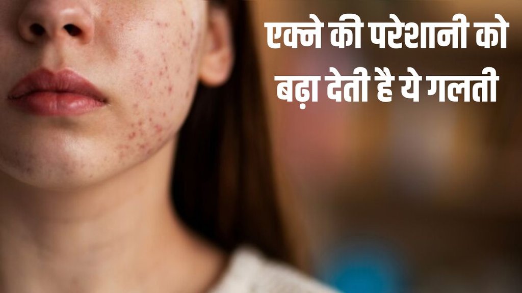 नींद से एक्ने का क्या है कनेक्शन, आइए जानते हैं- (P.C- Freepik)

