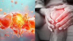 Uric Acid: क्या होता है यूरिक एसिड, नहीं दिया ध्यान तो जीवन भर रहेंगे परेशान, 5 रुपये का ये पत्ता दिलाएगा निजात