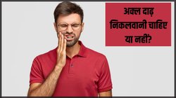 अक्ल दाढ़ निकलवानी चाहिए या नहीं? डेंटिस्ट के पास जाने से पहले जान लें Wisdom Teeth के फायदे-नुकसान