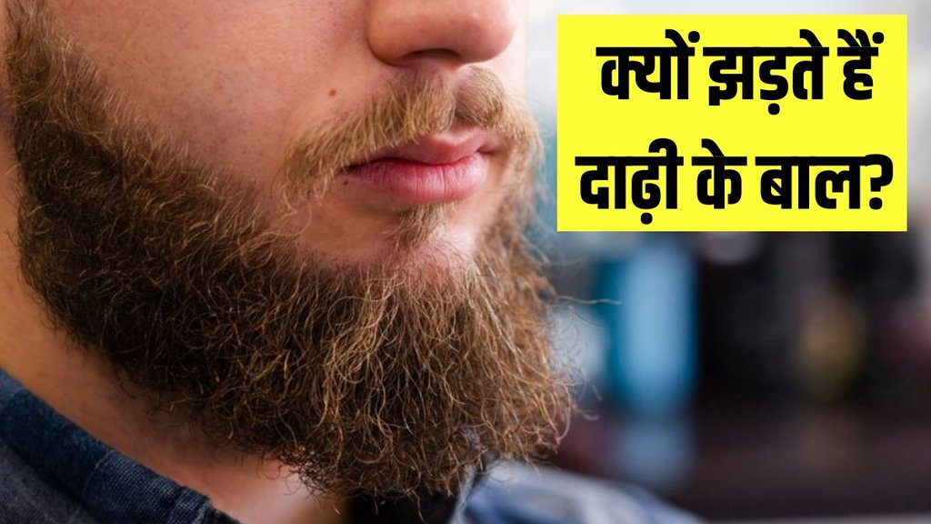 Beard Hair Loss । No Shave November । Bald patch in beard