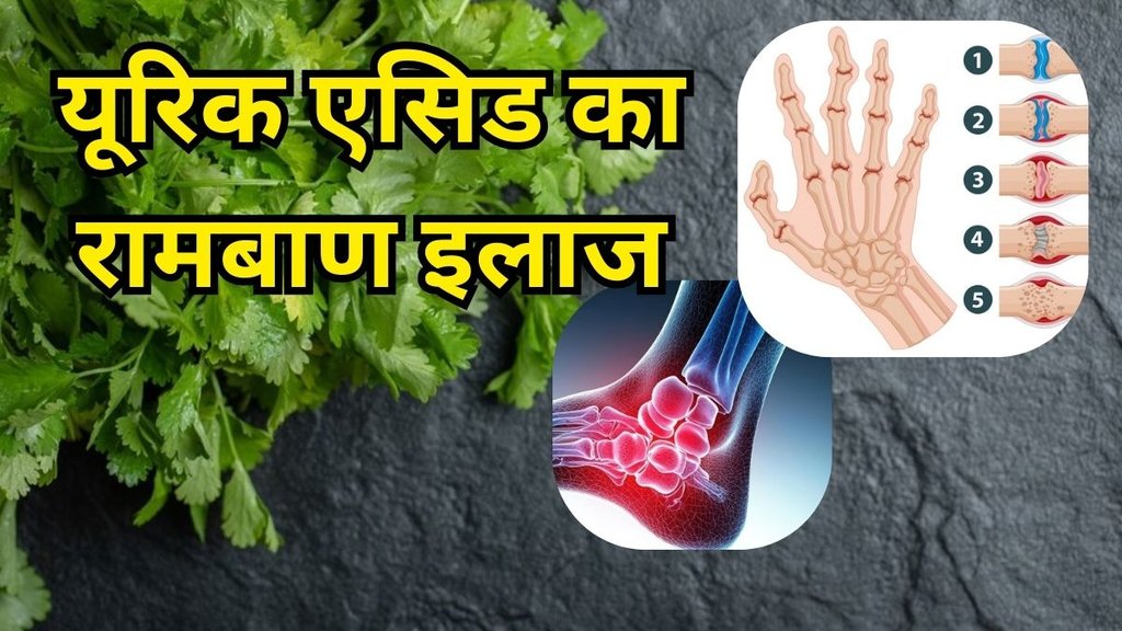 Coriander For Uric Acid: यूरिक एसिड के लिए रामबाण है धनिया की पत्तियां