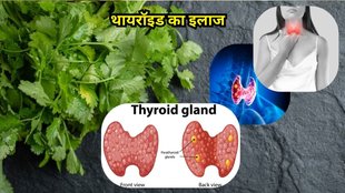 Coriander Leaves Control Thyroid: थायरॉइड का इलाज