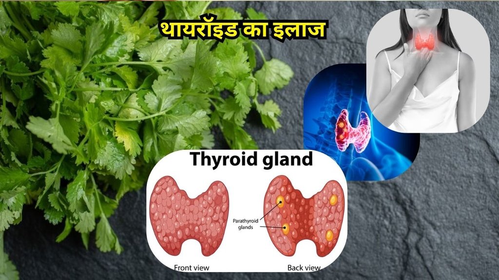 Coriander Leaves Control Thyroid: थायरॉइड का इलाज Coriander Leaves Control Thyroid: थायरॉइड का इलाज