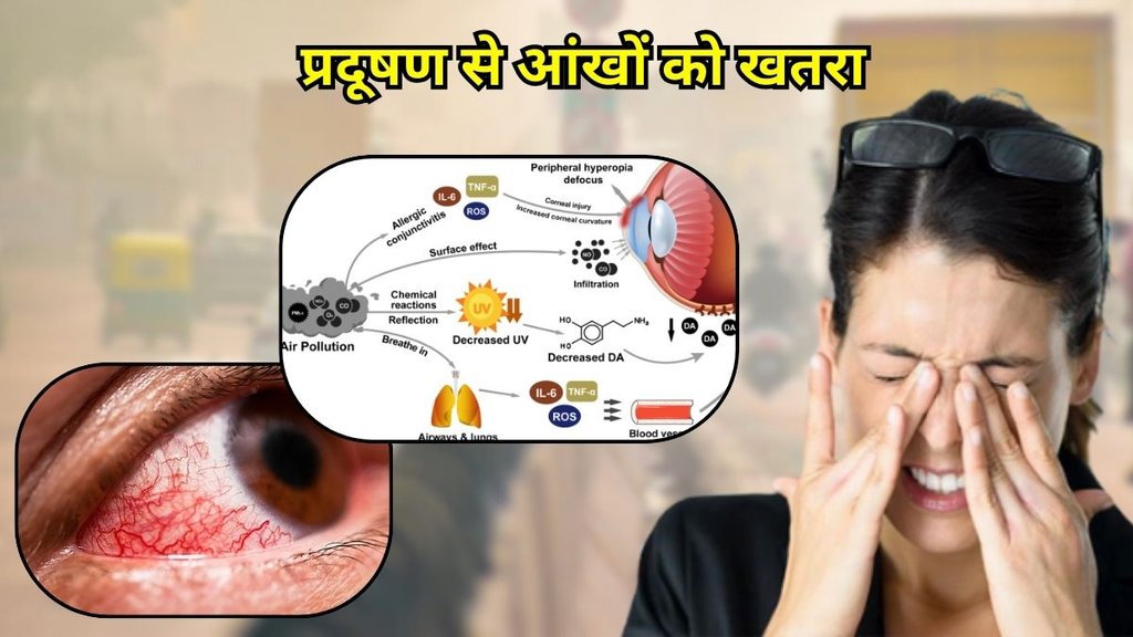 Effect of pollution on eyes: प्रदूषण से आंखों पर असर
