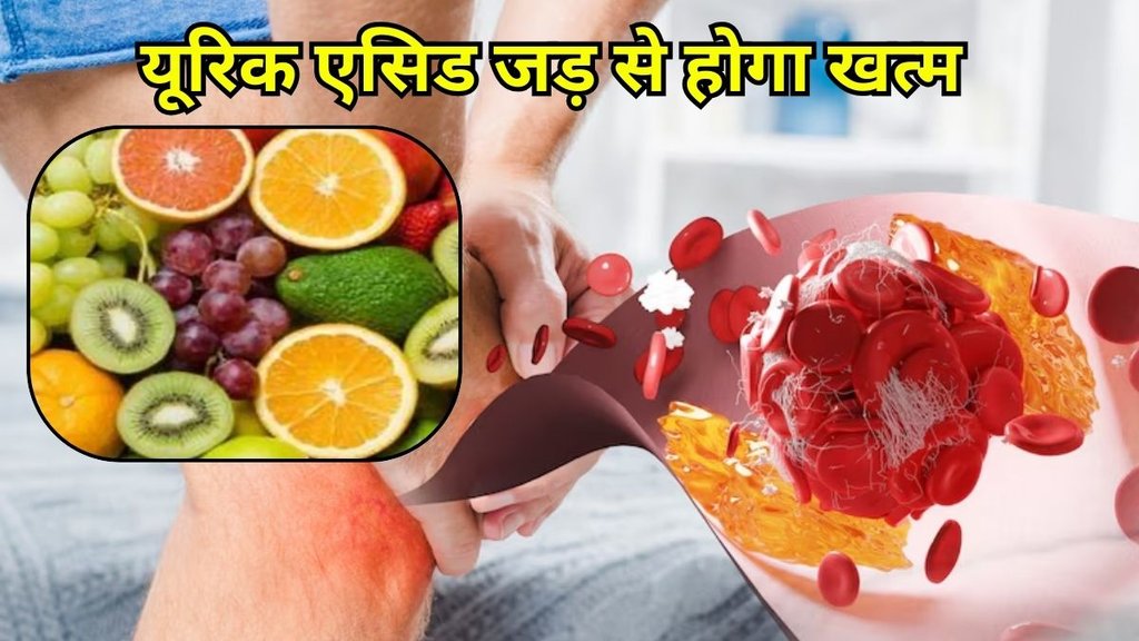 Fruit For Uric Acid Control: यूरिक एसिड को करें कंट्रोल