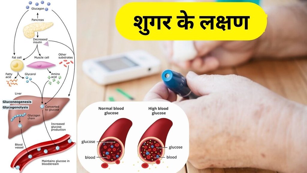 Health Tips diabetes symptoms: शुगर के लक्षण