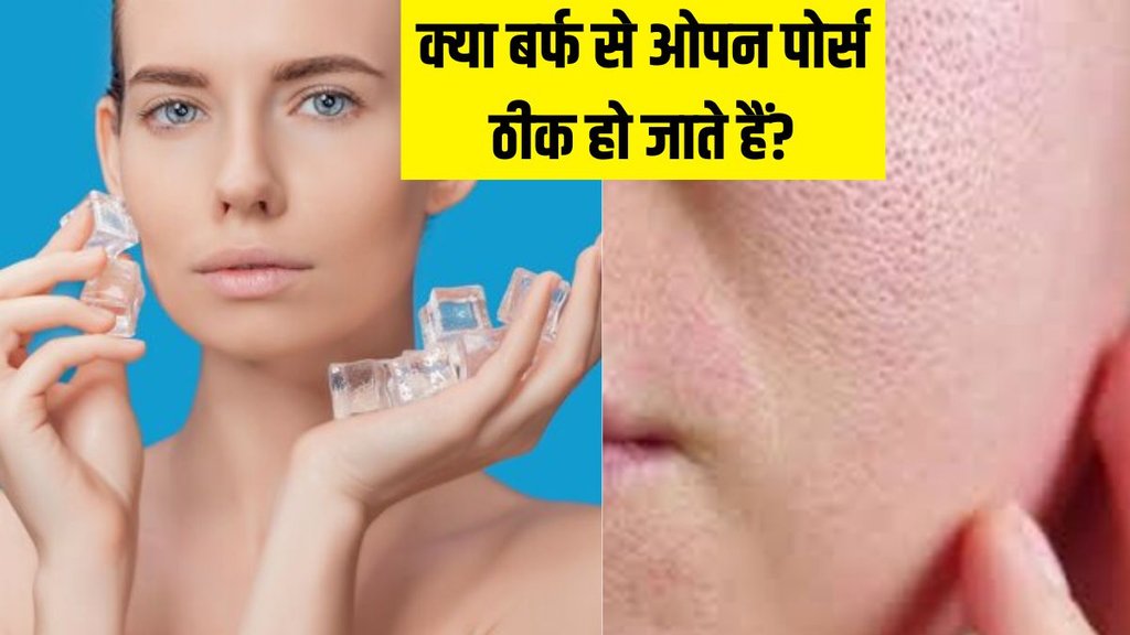 Ice For Open Pores । Open Pores Treatment । Open Pores on Face