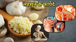 Garlic Benefits: रसोई में रखी इस चीज को रोज खा लें, स्टील सी बन जाएगी बॉडी, कई बीमारी भी होंगी गायब