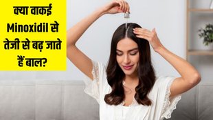 Minoxidil । What is Minoxidil । Minoxidil For hair growth