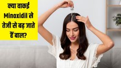 Minoxidil क्या है, क्या वाकई इससे तेजी से बढ़ जाते हैं बाल? इस्तेमाल से पहले एक्सपर्ट से जानें मिनोक्सिडिल के फायदे और नुकसान