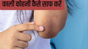 lighten dark elbows home remedies in hindi