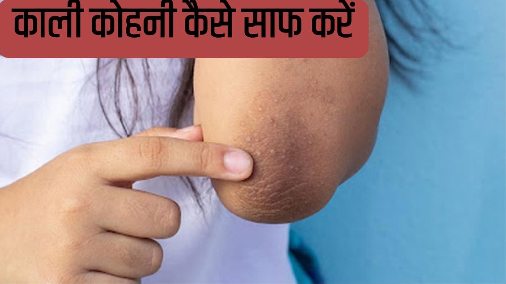 lighten dark elbows home remedies in hindi