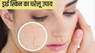 Home Remedies For Dry Skin in Winter