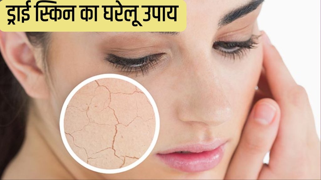 Home Remedies For Dry Skin in Winter